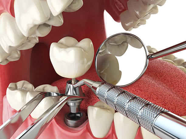 Best Emergency TMJ Treatment in Rockwood, TN